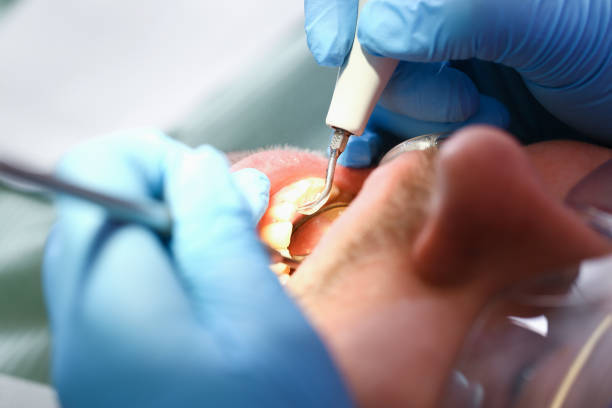 Best Urgent Care for Lost Fillings or Crowns in Lander, WY