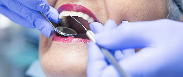 Best Emergency Tooth Extraction in Lander, WY